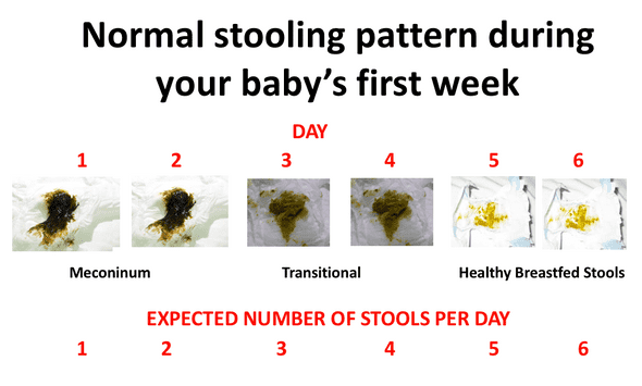 newborn stools